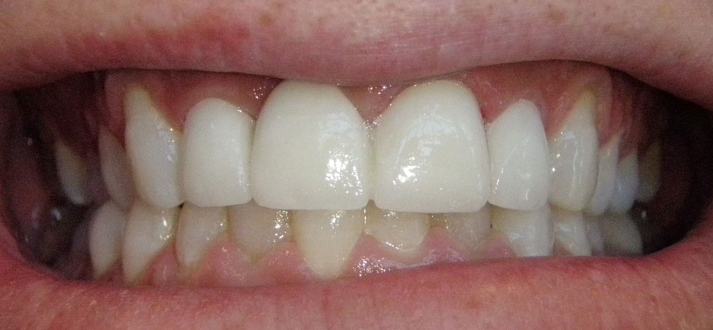  html    head  title 500 Internal Server Error  title   head    body    center  h1 500 Internal Server Error  h1   center    hr  center nginx 1.29.3  center     body     html 