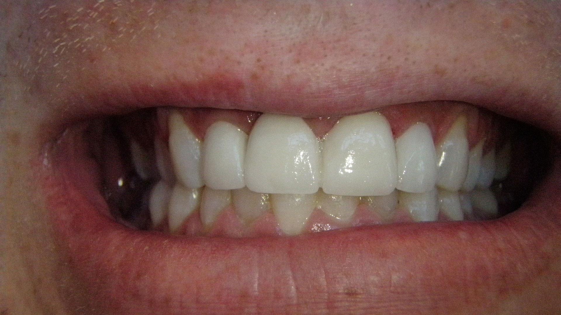  html    head  title 500 Internal Server Error  title   head    body    center  h1 500 Internal Server Error  h1   center    hr  center nginx 1.29.3  center     body     html 