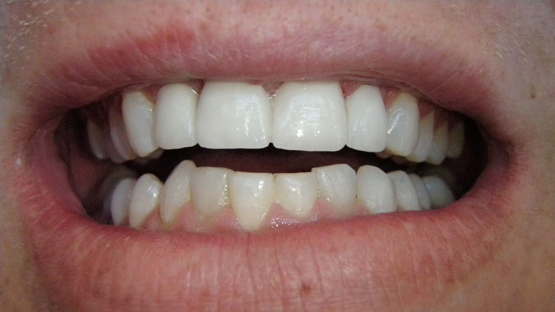  html    head  title 500 Internal Server Error  title   head    body    center  h1 500 Internal Server Error  h1   center    hr  center nginx 1.29.3  center     body     html 